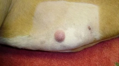 Тумор върху кожата